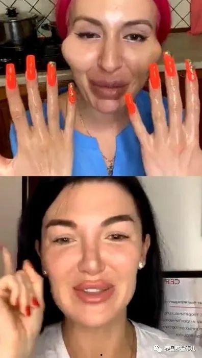 脸部打针视频,真实视频解析